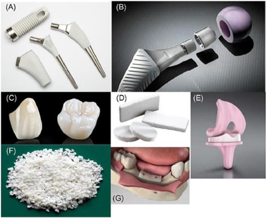Ceramics Types, Properties, and Industrial Applications